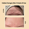 skin repairing